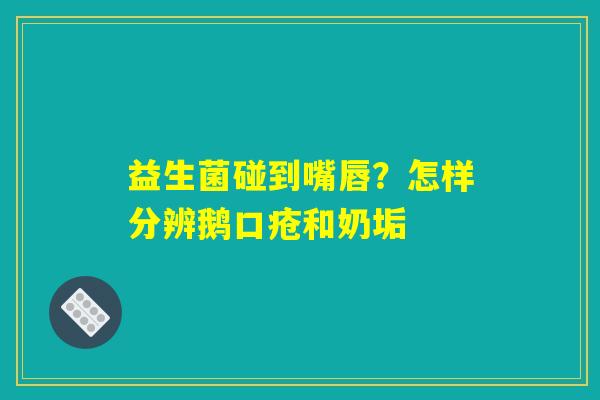 益生菌碰到嘴唇?怎样分辨鹅口疮和奶垢 益生菌碰到嘴唇?怎样分辨鹅口疮和奶垢