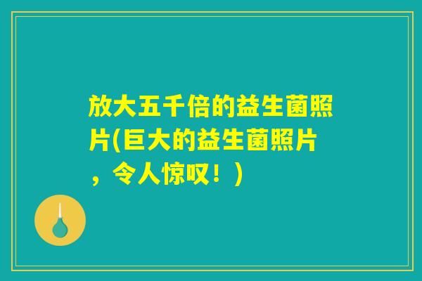放大五千倍的益生菌照片(巨大的益生菌照片,令人惊叹!) 放大五千倍的益生菌照片(巨大的益生菌照片,令人惊叹!)