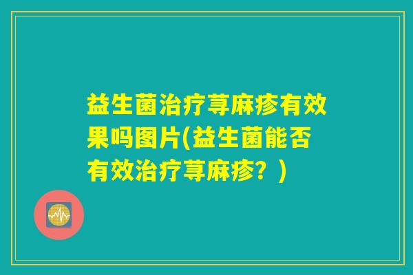 益生菌治疗荨麻疹有效果吗图片(益生菌能否有效治疗荨麻疹？)