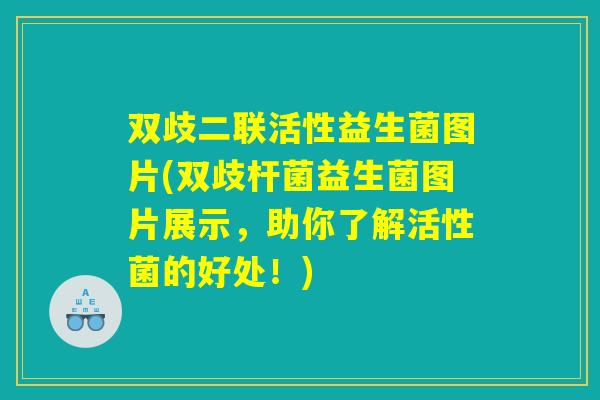 双歧二联活性益生菌图片(双歧杆菌益生菌图片展示，助你了解活性菌的好处！)