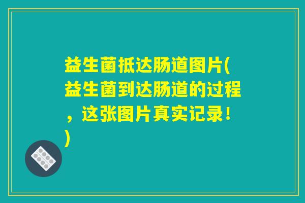 益生菌抵达肠道图片(益生菌到达肠道的过程,这张图片真实记录!) 益生菌抵达肠道图片(益生菌到达肠道的过程,这张图片真实记录!)
